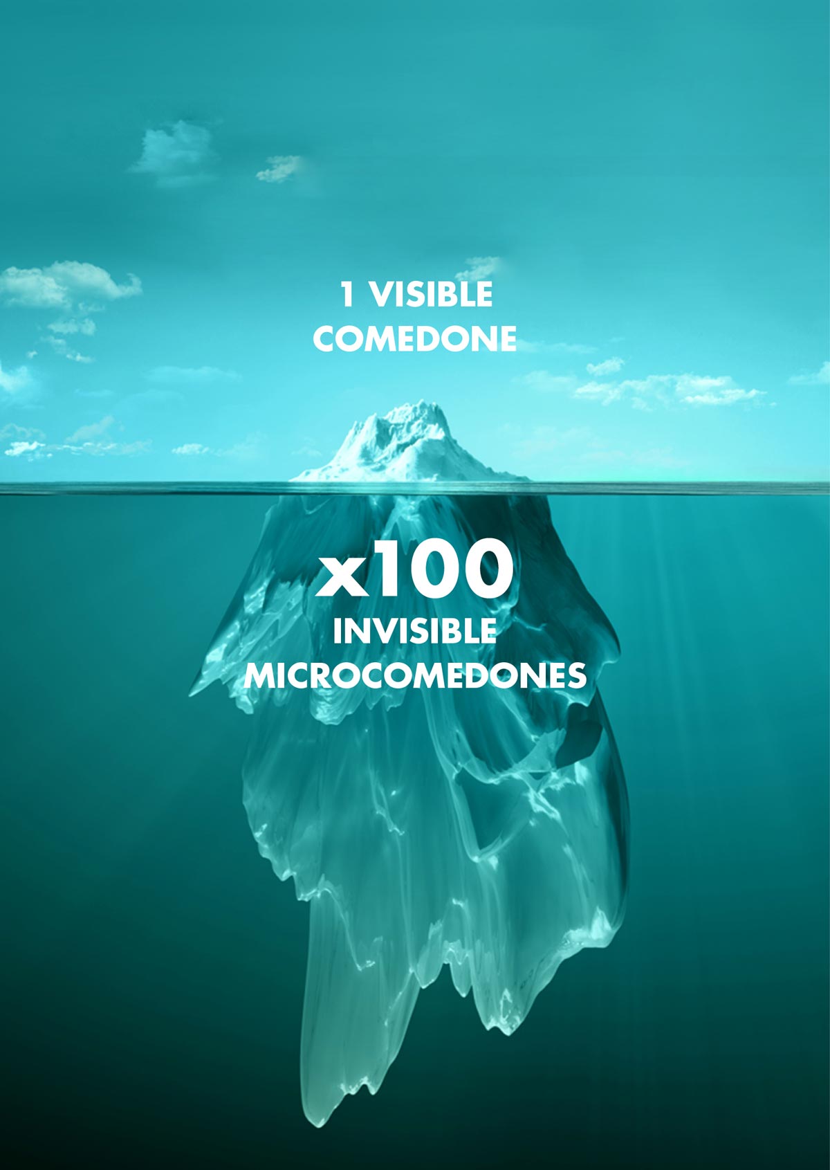 1 Visible Comedone - x100 invisible microcomedoned